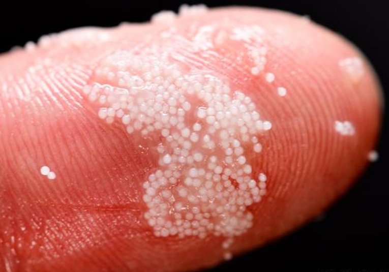  Detectan por primera vez diminutas partí­culas de plástico en la sangre humana detectan-por-primera-vez-diminutas-particulas-de-pl-stico-en-la-sangre-humana-160310-160333.jpg