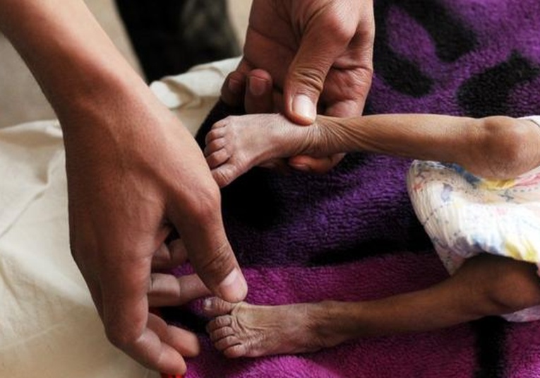 El Ministerio de Salud confirmó que por lo menos seis niños han perdido la vida en lo que va del año el-ministerio-de-salud-confirmo-que-por-lo-menos-seis-ninos-han-perdido-la-vida-en-lo-que-va-del-ano-191158-191342.jpg