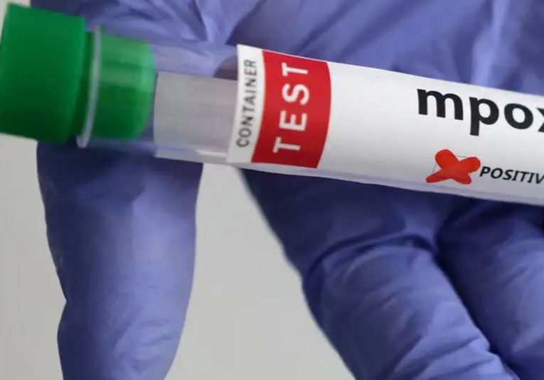 Identificados casos de nueva variante de mpox en Alemania identificados-casos-de-nueva-variante-de-mpox-en-alemania-140352-140414.jpg