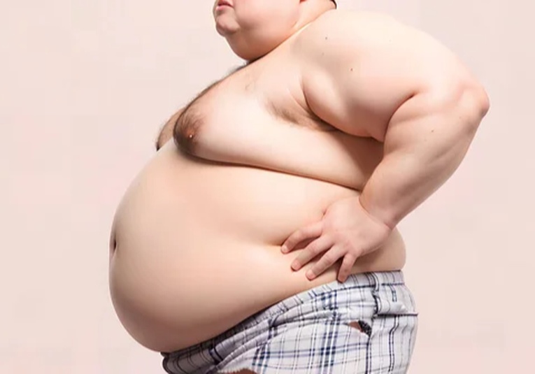 Nuevo estudio: 1 de cada 8 personas en el mundo es obesa nuevo-estudio-1-de-cada-8-personas-en-el-mundo-es-obesa-114420-114747.jpg