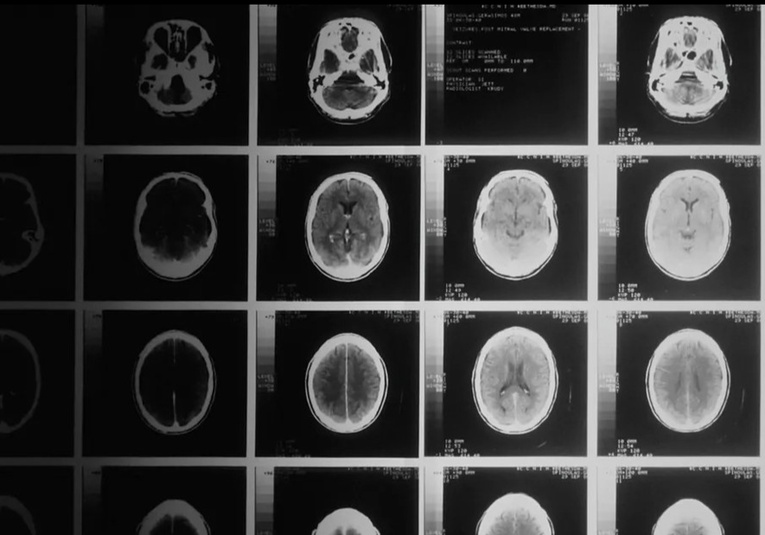 Nuevo gel detiene los tumores cerebrales en ratones con una eficacia del 100% nuevo-gel-detiene-los-tumores-cerebrales-en-ratones-con-una-eficacia-del-100-100943-101032.jpg