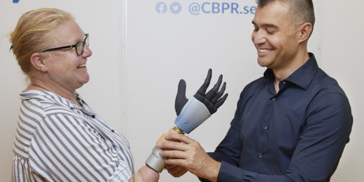 Acoplan una revolucionaria mano biónica con inteligencia artificial