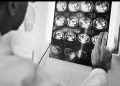 Alerta de salud por padecimiento neurológico