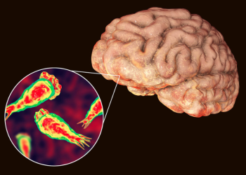 Ameba 'comecerebros' mata a un hombre en Israel