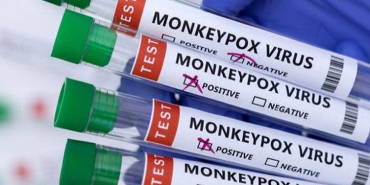 Argentina confirma su primer caso de viruela del mono