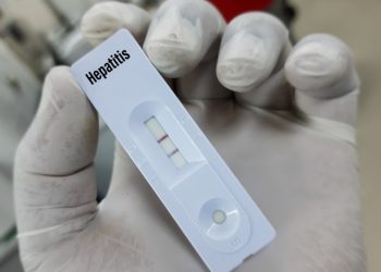 Argentina registra el primer caso de hepatitis aguda grave de origen desconocido