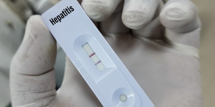 Argentina registra el primer caso de hepatitis aguda grave de origen desconocido