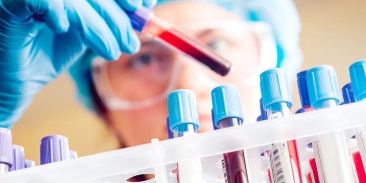 Aumenta el número de casos confirmados de viruela del mono en el mundo