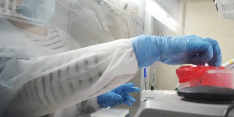 Aumentan a 80 los casos de síndrome de Guillain-Barré en el país
