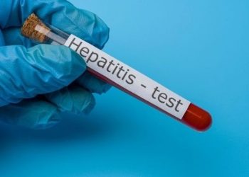 Aumentan casos de Hepatitis en el paí­s