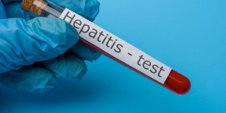 Aumentan casos de Hepatitis en el país