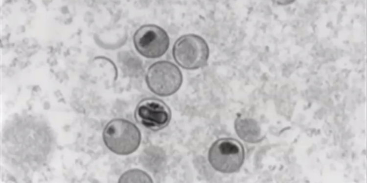 Autoridades de salud confirman segundo caso de viruela del mono en el paí­s