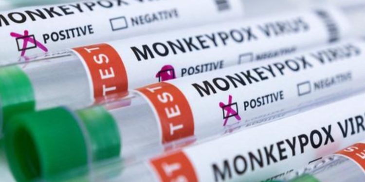 Brasil y España registran las primeras muertes por viruela del mono