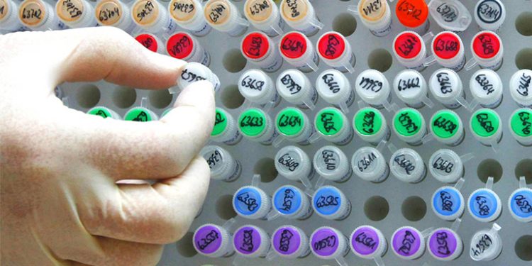 Buscan detectar variantes de Covid 19 en el país