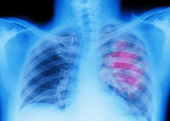 Casi la mitad de las muertes por cáncer se atribuyen a factores de riesgo evitables