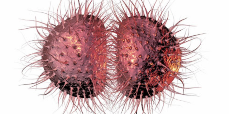 Casos de la ETS Supergonorrea se elevan