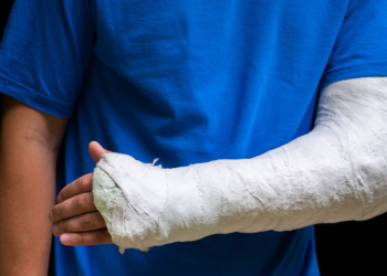 Científicos rusos crean el primer gel que regenera completamente los huesos