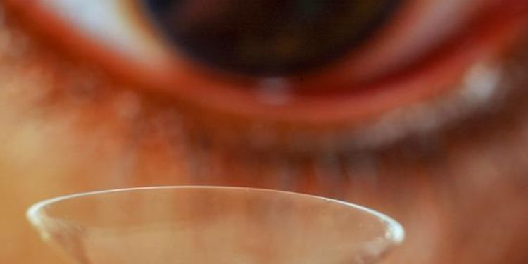 Córneas sintéticas fabricadas a partir de una fuente improbable devuelven la vista a 20 personas