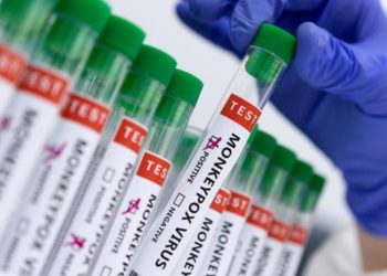 Costa Rica reporta primer caso sospechoso de viruela del mono