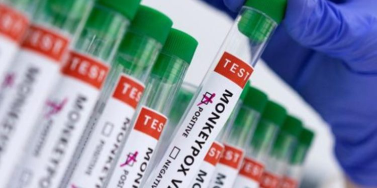 Costa Rica reporta primer caso sospechoso de viruela del mono