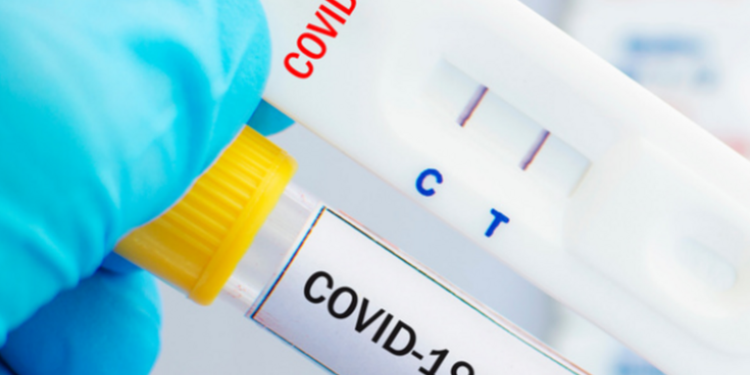 COVID: investigadores chinos desarrollan test preciso de 4 minutos