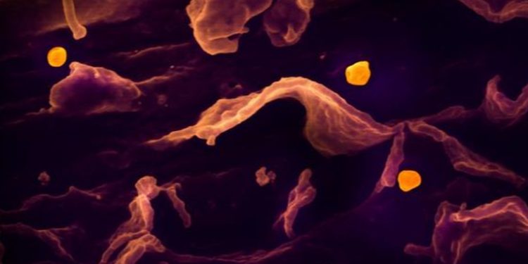 Descubren 35 casos de un nuevo virus de origen animal en China