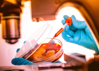 Descubren en Chipre una nueva cepa del VIH-1