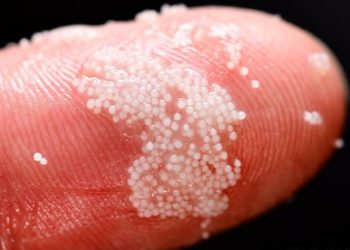 Detectan por primera vez diminutas partí­culas de plástico en la sangre humana