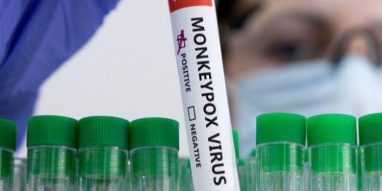 Detectan primer caso de viruela del mono en México