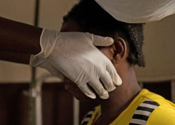 EE.UU., Suecia y Gran Canaria detectan primeros casos de viruela del mono