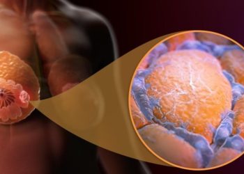 El cáncer de mama se propaga cuando dormimos, según un nuevo estudio