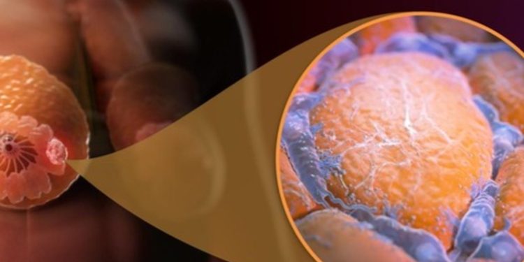 El cáncer de mama se propaga cuando dormimos, según un nuevo estudio