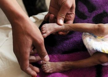 El Ministerio de Salud confirmó que por lo menos seis niños han perdido la vida en lo que va del año