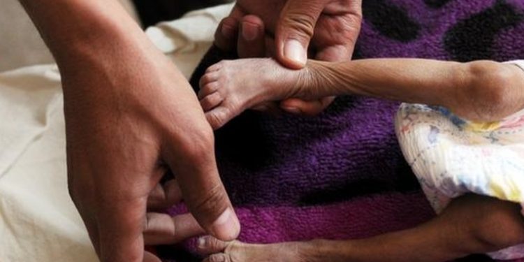 El Ministerio de Salud confirmó que por lo menos seis niños han perdido la vida en lo que va del año