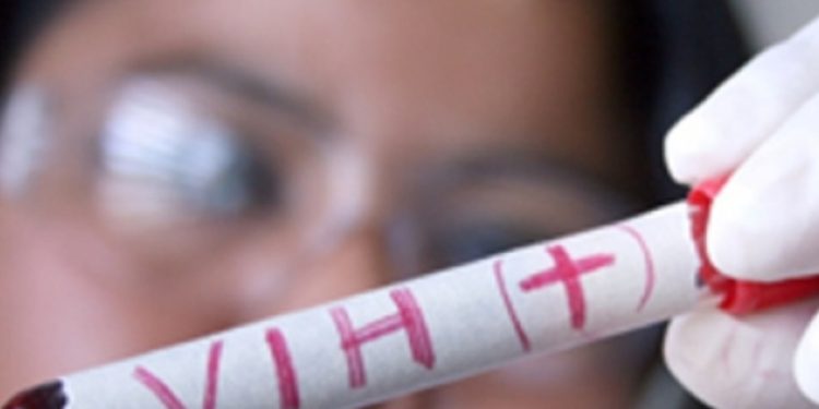 El paciente de Dí¼sseldorf, el tercer recuperado del VIH tras recibir un trasplante de células madres