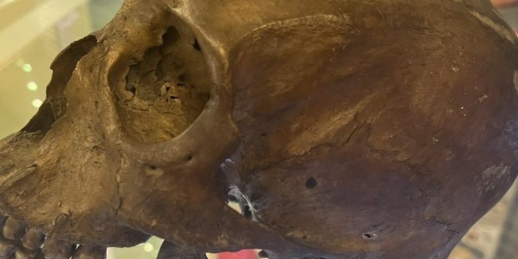 Encuentran un cráneo humano en venta en una tienda de antigüedades en EE.UU.