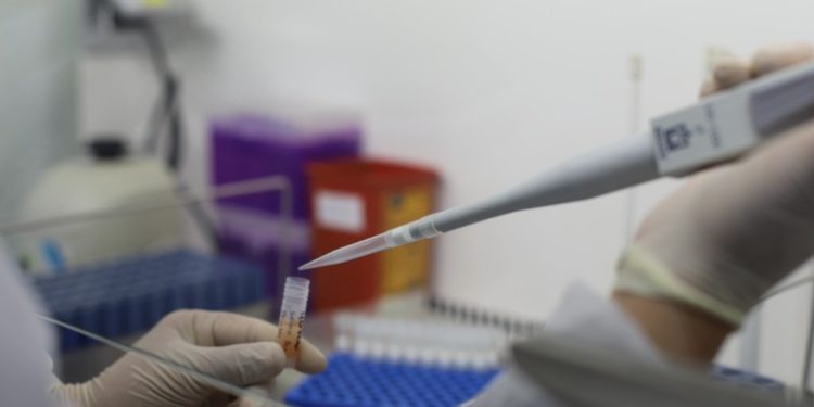 Estudio revelan daños a largo plazo al corazón por COVID-19