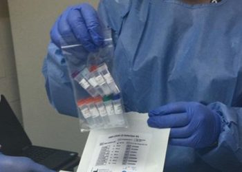 Fabrica se desliga de responsabilidad sobre supuesto fraude de test Covid