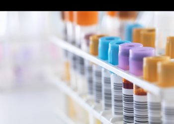 Ghana confirma sus dos primeros casos del virus de Marburgo, una enfermedad altamente infecciosa similar al ébola