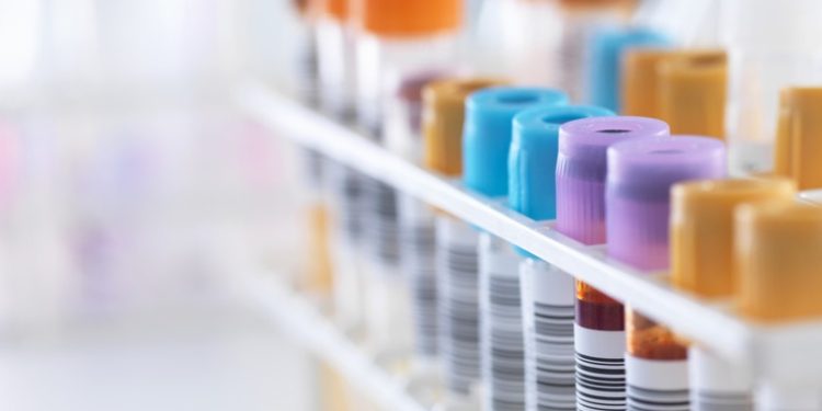 Ghana confirma sus dos primeros casos del virus de Marburgo, una enfermedad altamente infecciosa similar al ébola