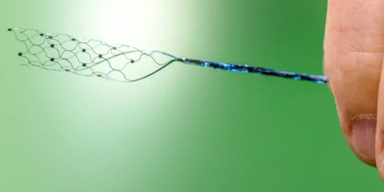 Hombre con parálisis se comunica gracias a implante cerebral