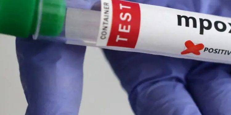 Identificados casos de nueva variante de mpox en Alemania