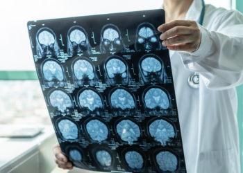Inician en EE.UU. el primer ensayo clí­nico de una vacuna nasal contra el alzhéimer