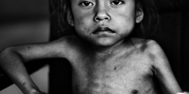 Iniciativa a la ley del sistema de Seguridad Alimentaria y Nutricional es presentada