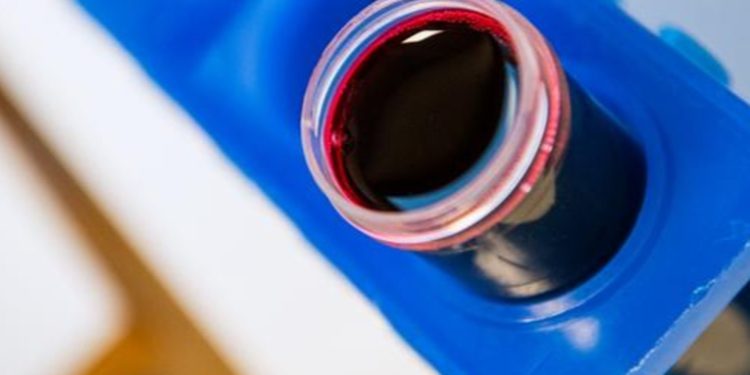 Investigadores logran la primera transfusión de sangre creada en un laboratorio