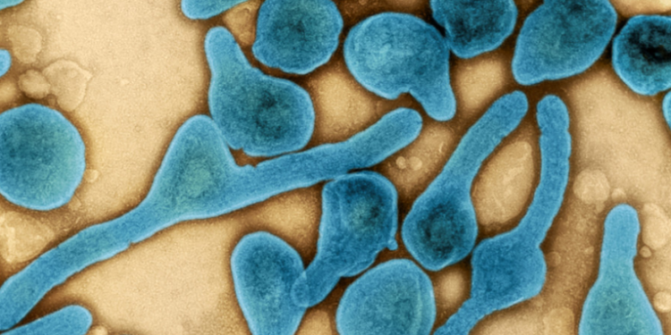 La enfermedad del virus de Marburgo: ¿qué es y cómo afecta a los humanos?