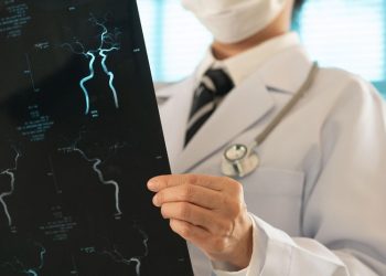 La mortalidad por ictus baja un 30%, pero deja secuelas invisibles con las que convivir