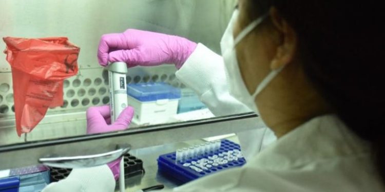 Ministerio de Salud enví­a mas de 90 muestras a Panamá