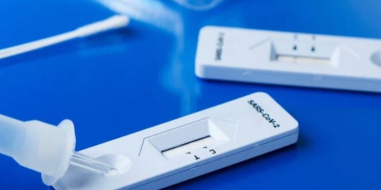 Ministerio de Salud Pública autoriza venta libre de pruebas caseras de Covid-19