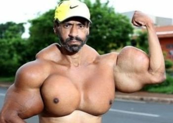 Muere en el dí­a de su cumpleaños el 'Hulk' brasileño